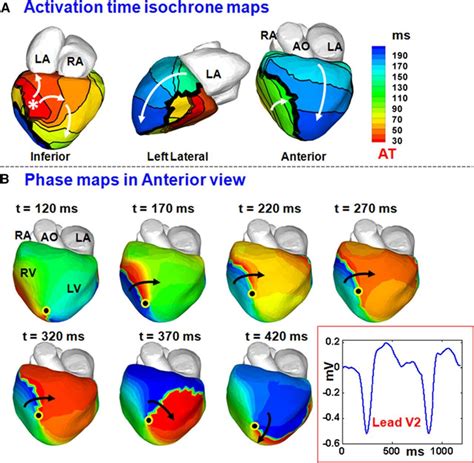 electrophysiology arrhythmia near occidental|Fundamentals of Cardiac Mapping .